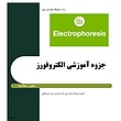 الکتروفورز،الکتروفورز هموگلوبین، الکتروفورز سرم ، الکتروفورز هموگلوبین، الکتروفورز ادرار، الکتروفورز CSF